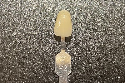 2M1